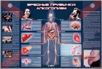 Электрифицированный стенд "Вредные привычки: алкоголизм" - «globural.ru» - Томск