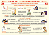Таблица Порядок действий при опасном кровотечении 1000*1400 винил - «globural.ru» - Томск